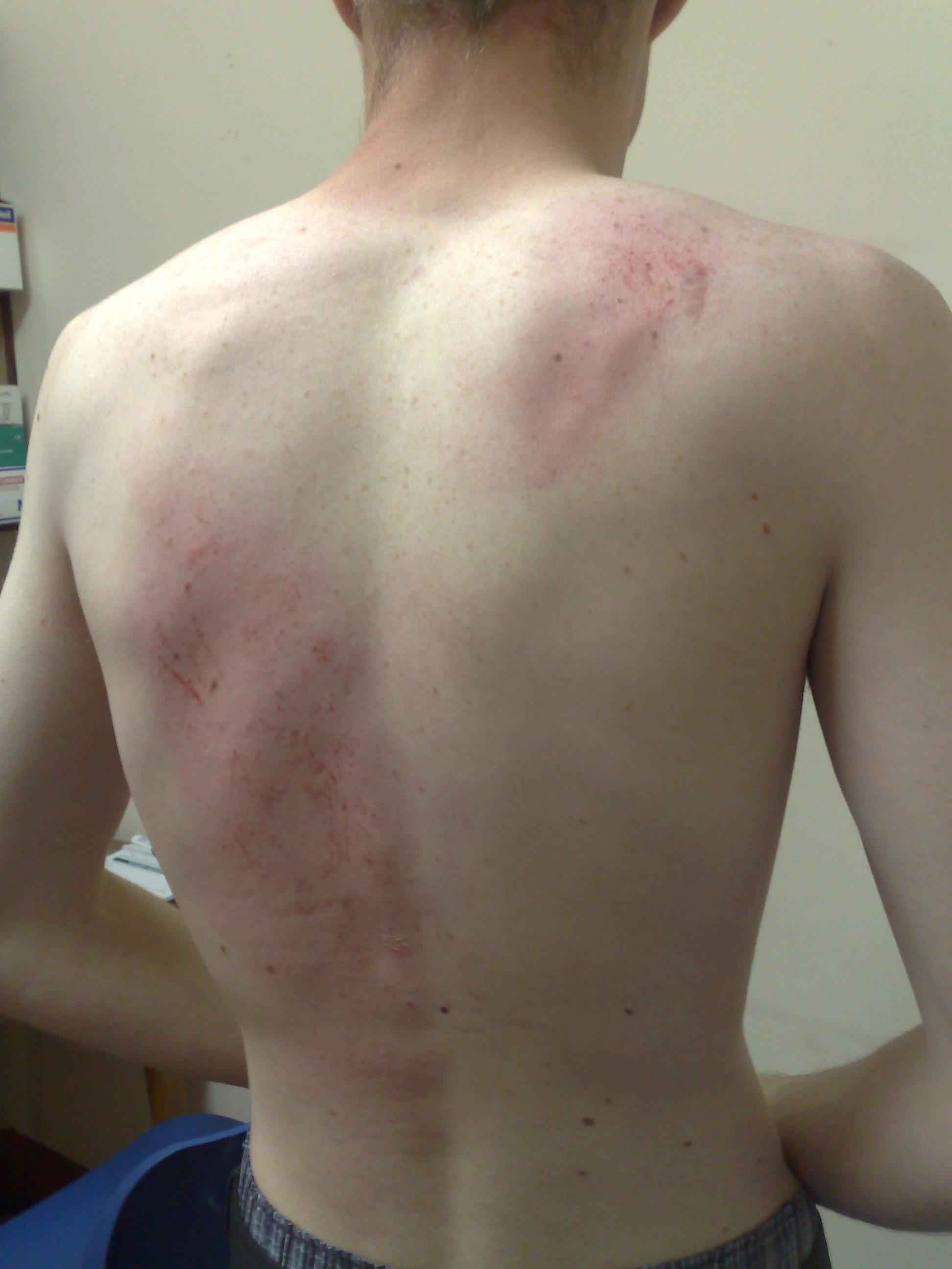back_scratch_1